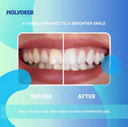Holydeer 7.5% nHAP toothpaste, made simple.